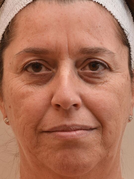 Così ho guardato prima di usare la crema eudalie