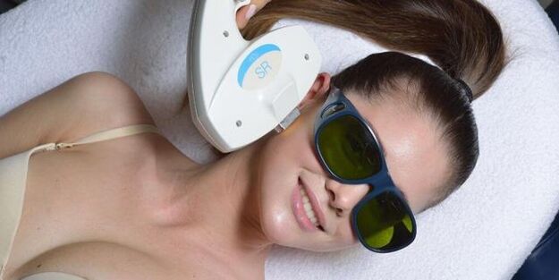 Ringiovanimento dell'Elos